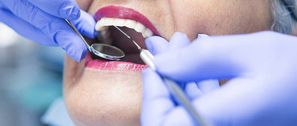 Best Dental Abscess Treatment in Martinsville, VA