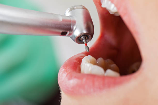 Best 24-Hour Emergency Dental Care in Martinsville, VA